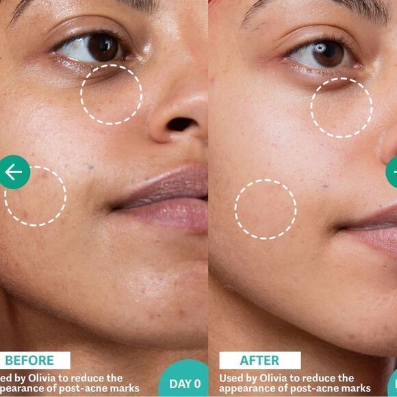 Selfless by Hyram Retinol & Rainbow Algae Repair Serum helps repair acne scars + - Picture 4 of 8